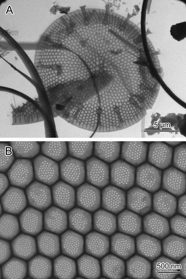 Transmitted electron image